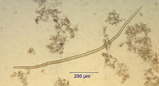 Case155_A.jpg