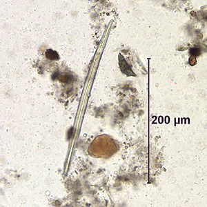 Case155_B.jpg