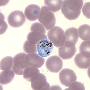 Case157_B.jpg