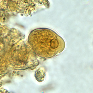 Case158_A.jpg