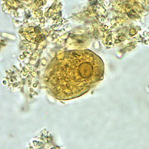 Case158_B.jpg