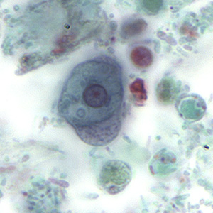 Case158_C.jpg
