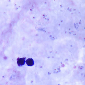 Case160_A.jpg
