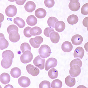 Case160_B.jpg