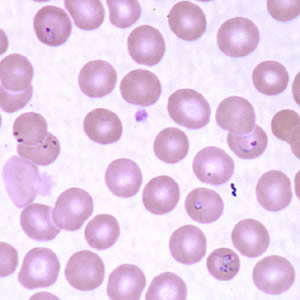 Case160_C.jpg