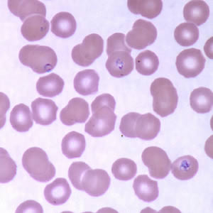Case160_D.jpg