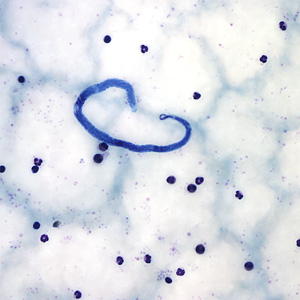 Case161_A.jpg