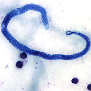 Case161_B.jpg