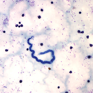 Case161_C.jpg