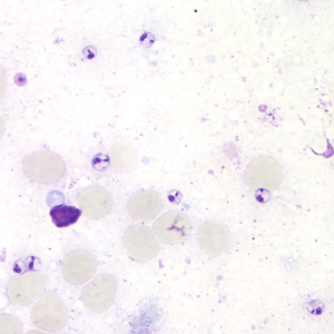 Case164_C.jpg