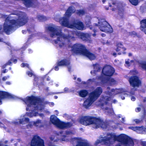 Case164_E.jpg