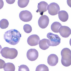 Case165_C.jpg