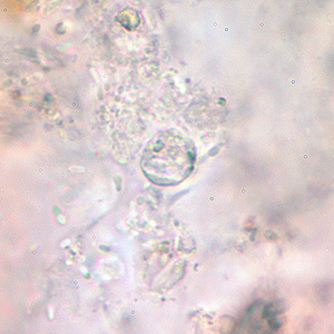 Case166_A.jpg