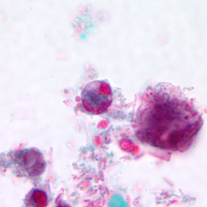 Case166_B.jpg