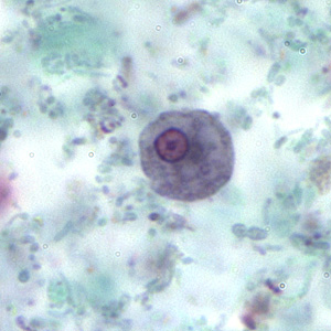 Case167_A.jpg