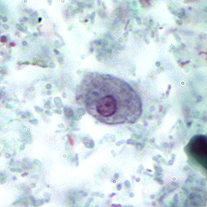 Case167_B.jpg
