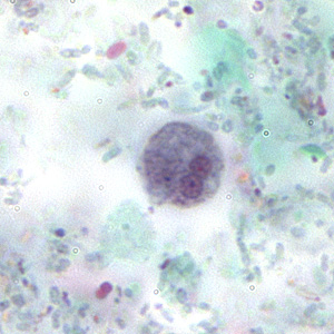 Case167_C.jpg