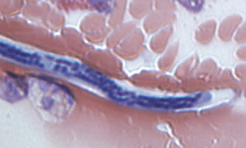 Case168_F.jpg
