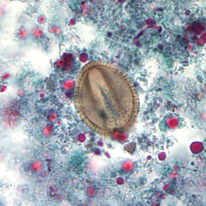 Case169_A.jpg