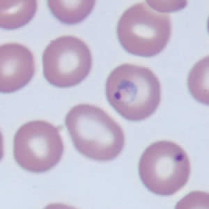 Case171_B.jpg