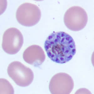 Case171_D.jpg