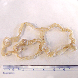 Case172_A.jpg