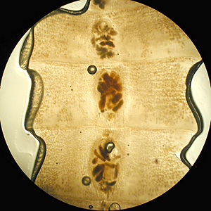 Case172_C.jpg
