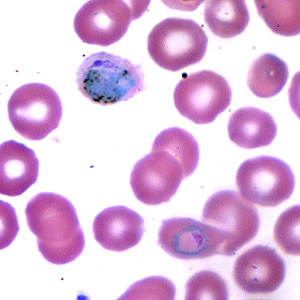 Case173_A.jpg