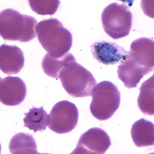 Case173_C.jpg