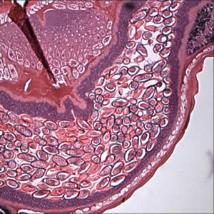 Case175_A.jpg