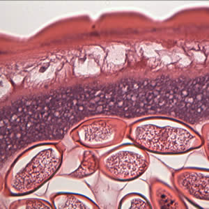 Case175_B.jpg