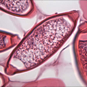 Case175_C.jpg