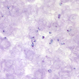 Case177_A.jpg