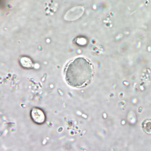 Case178_A.jpg