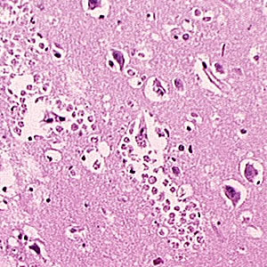 Case181_A.jpg
