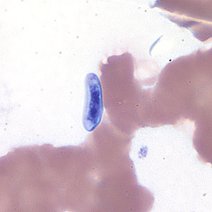 Case184_A.jpg