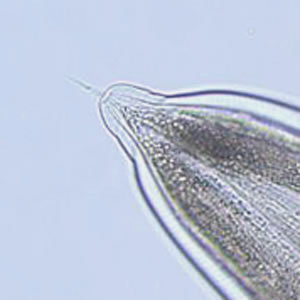 Case185_C.jpg