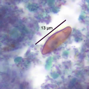 Case186_B.jpg