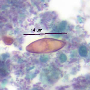 Case186_C.jpg