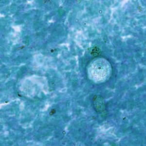 Case187_A.jpg