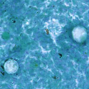 Case187_B.jpg