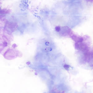 Case190_A.jpg