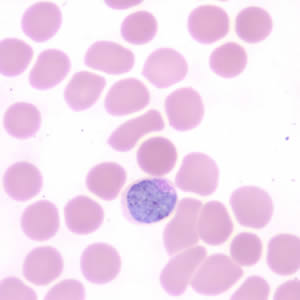 Case190_D.jpg