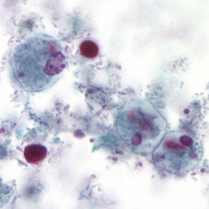 Case194_A.jpg