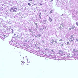 Case195_C.jpg Case195
