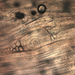 Case199_D.jpg