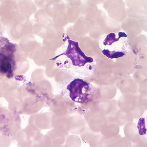 Case200_C.jpg