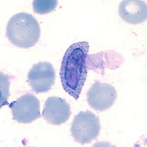 Case202_A.jpg Case202