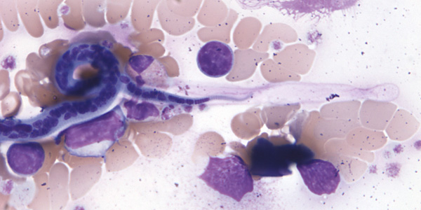 Case206_B.jpg