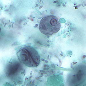 Case207_A.jpg